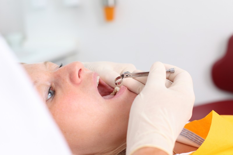 Why Dental Health Care is So Important