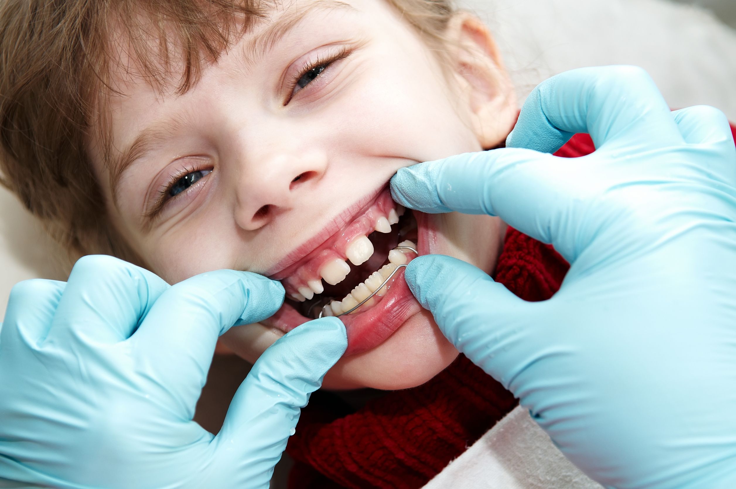 Caring for Your Braces After Visiting a Hinsdale Orthodontist