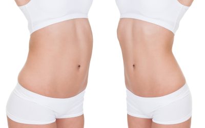 Popular Minimally Invasive Procedures in Mommy Makeovers in Boston, MA