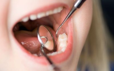 Three Pain Management Innovations in General Dentistry in Willmar for Comfortable Dental Procedures