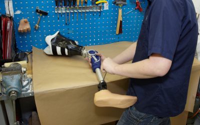 Transforming Lives: Innovative Calipers For Polio Legs in India